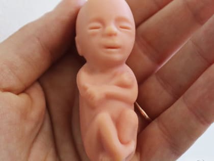 РПЦ: замужняя женщина не должна делать аборт без согласия супруга