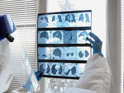 За сутки в Тверской ковидом заболел 171 человек