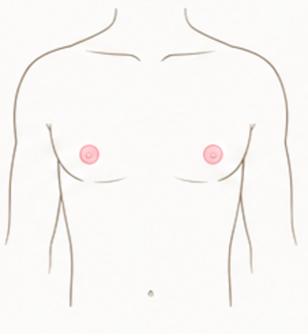 Areola