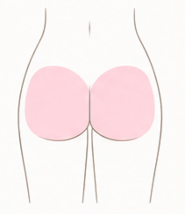 Buttocks