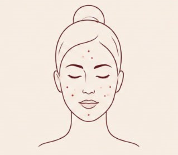 Active Breakouts
