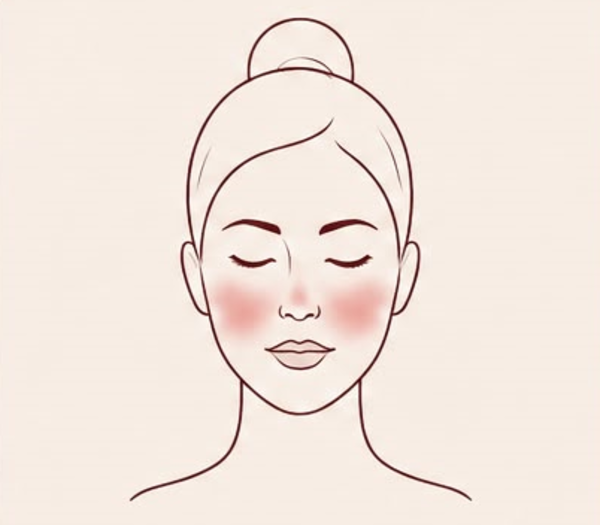 Redness & Rosacea