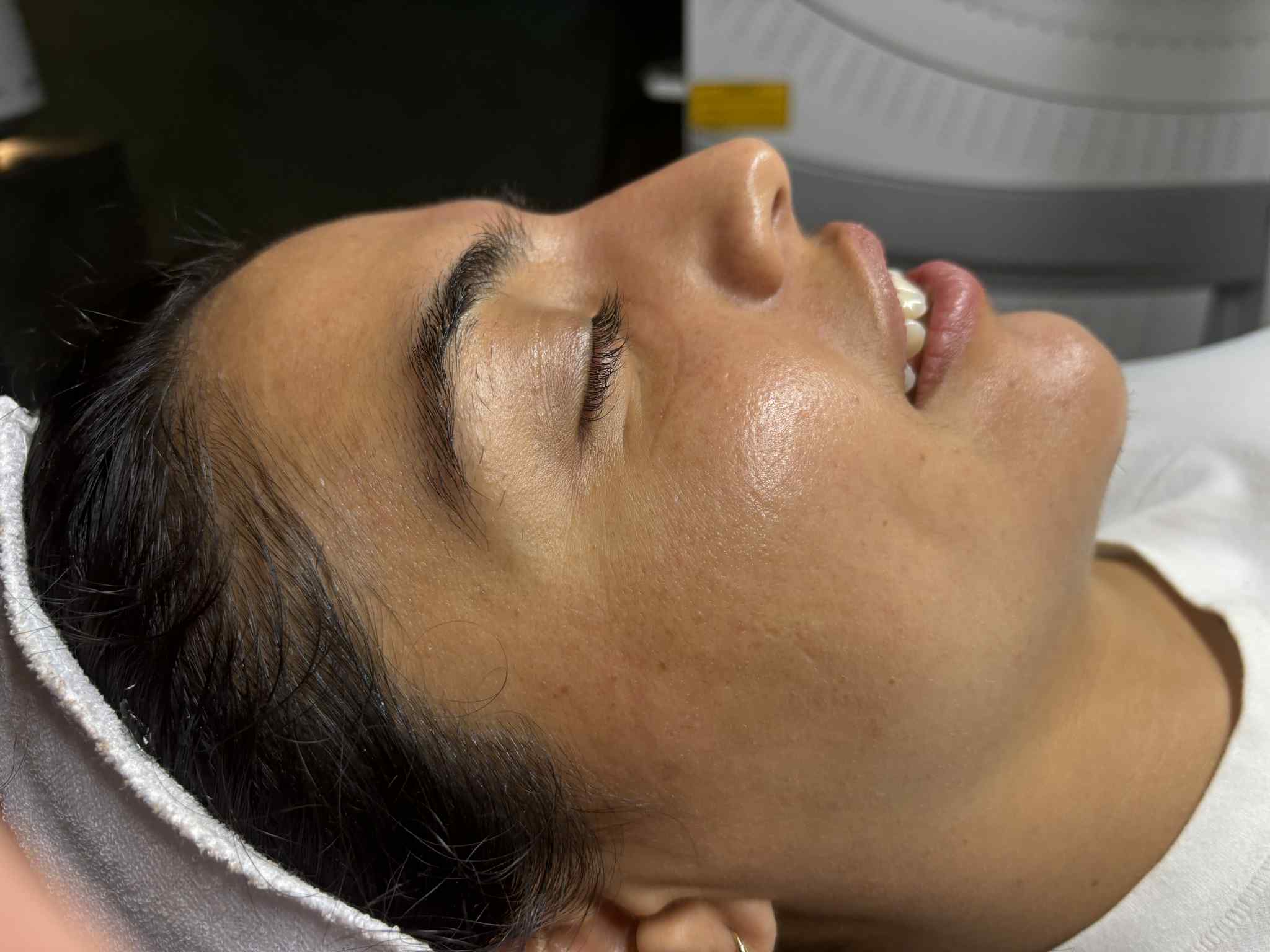 Client receiving skin consultation