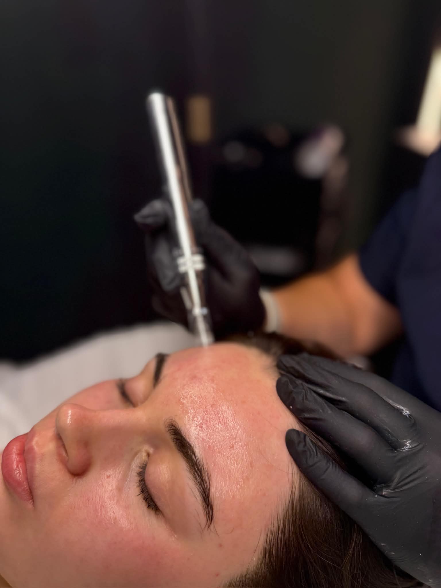 pHformula Skin Resurfacing