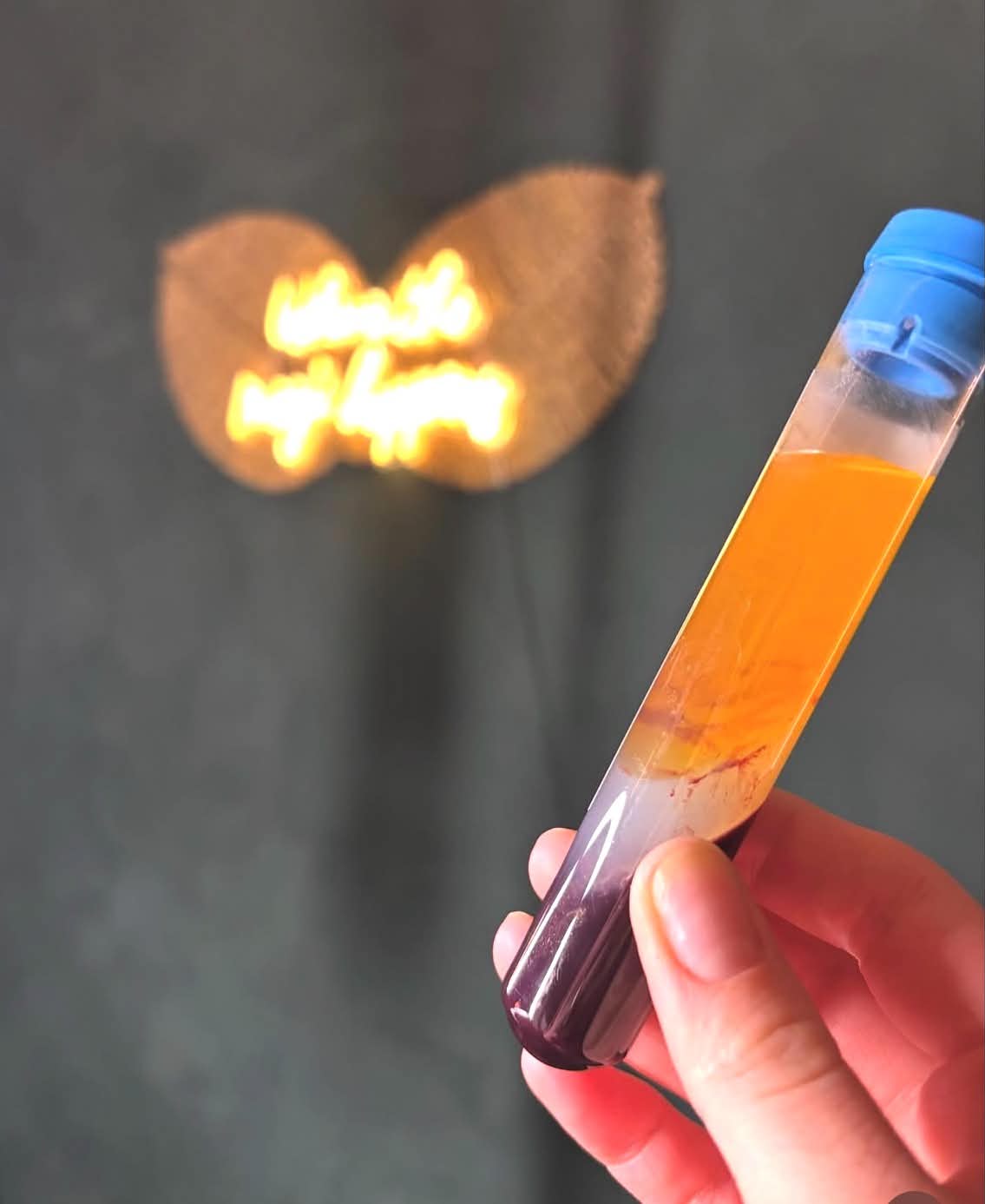 Platelet Rich Plasma (PRP)