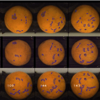 Advanced Defect Sorting: Precise Detection of Surface Defects