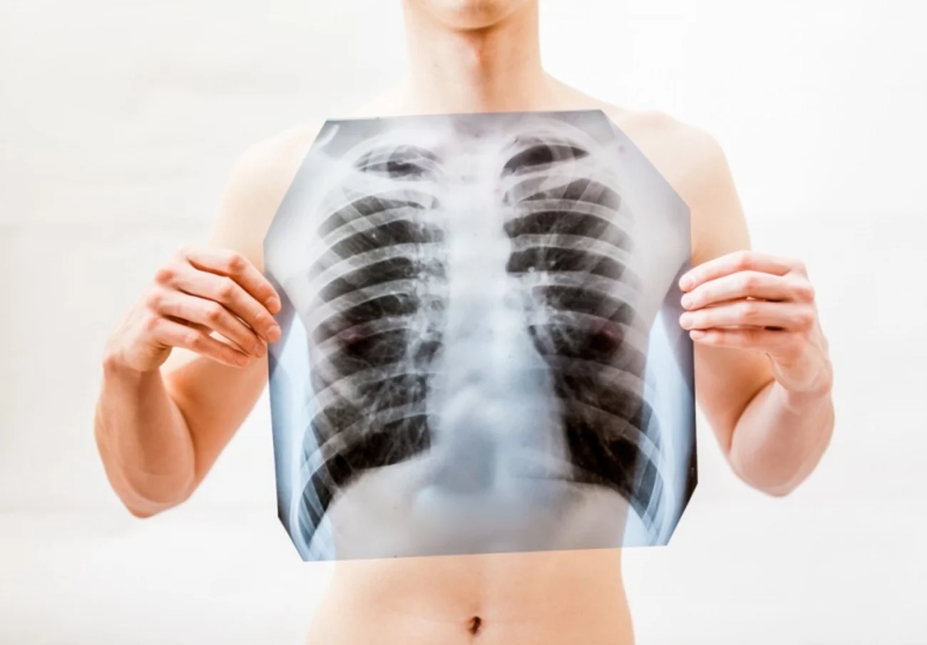 What Is Chest Cancer?