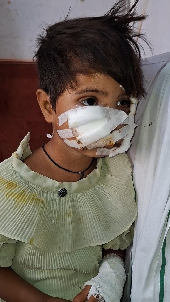 बाराबंकी - बाराबंकी में थमने का नाम नहीं आवारा कुत्तों का आतंक!आवारा कुत्तों ने बीते एक सप्ताह में आधा दर्जन से अधिक ग्रामीणों और कई पालतू पशुओं बनाया अपना शिकार !