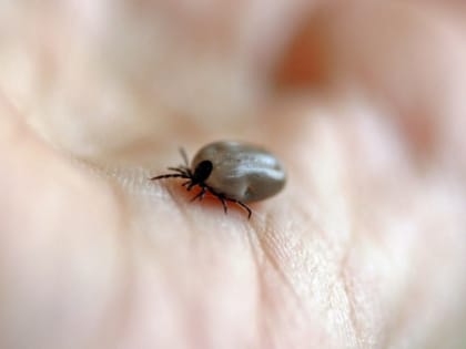 Клещи боятся этого средства, как огня: достаточно всего нескольких капель