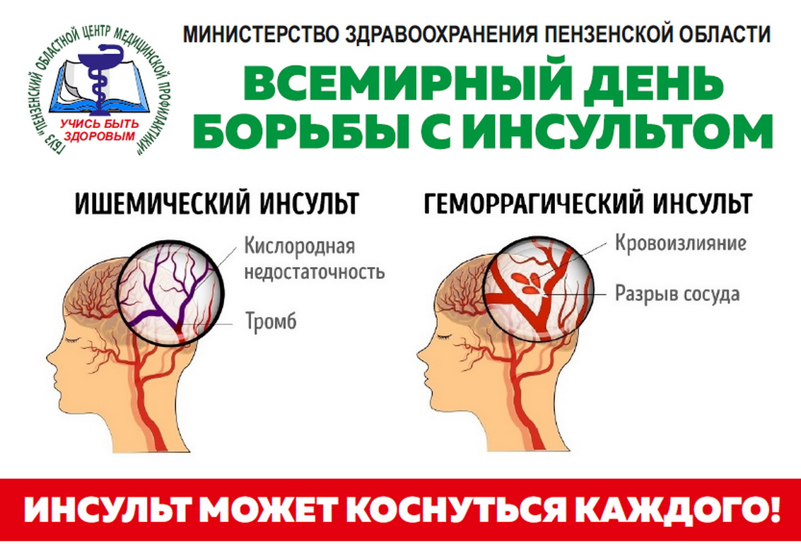 Инсульт статья. День борьбы с инсультом. Инсульт картинки. Профилактика против инсульта. Борьба с инсультом картинки.