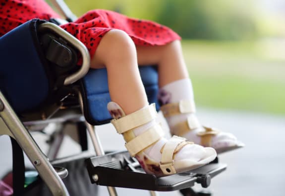 Serebral iflic yeni tibbi xidmətlər zərfinə daxil edilib