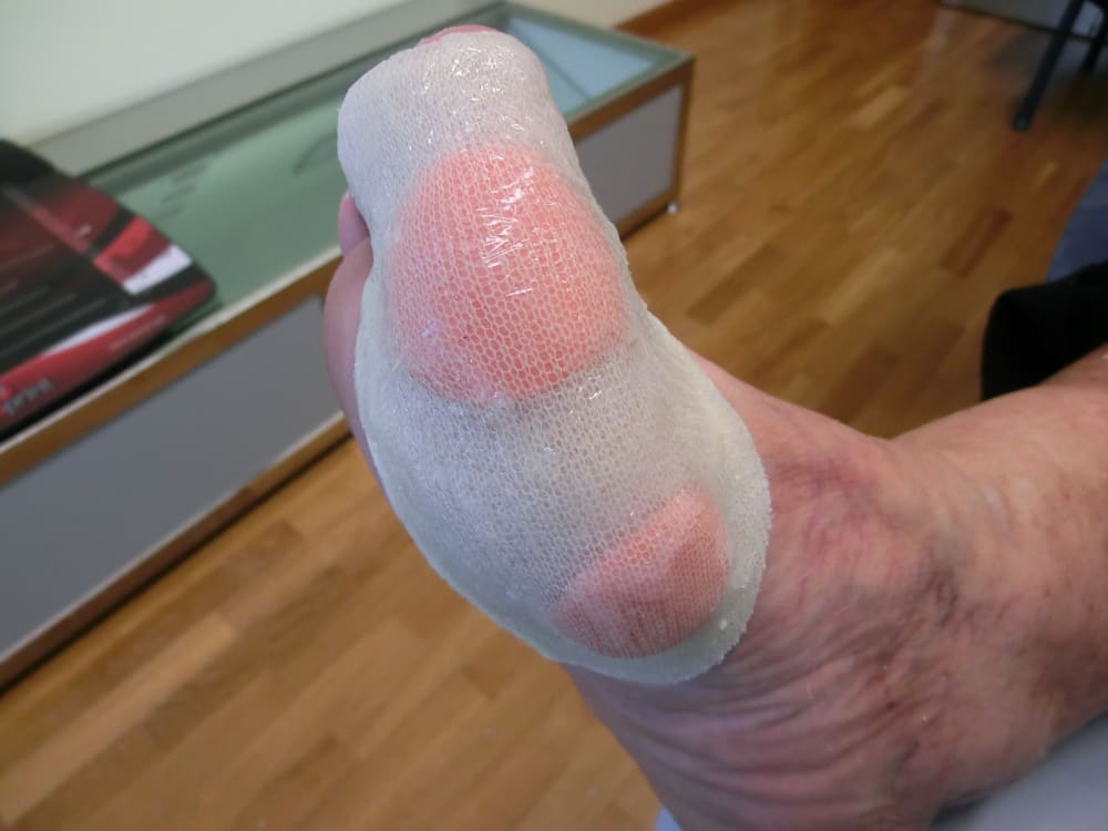 Ortesis lateral del pie