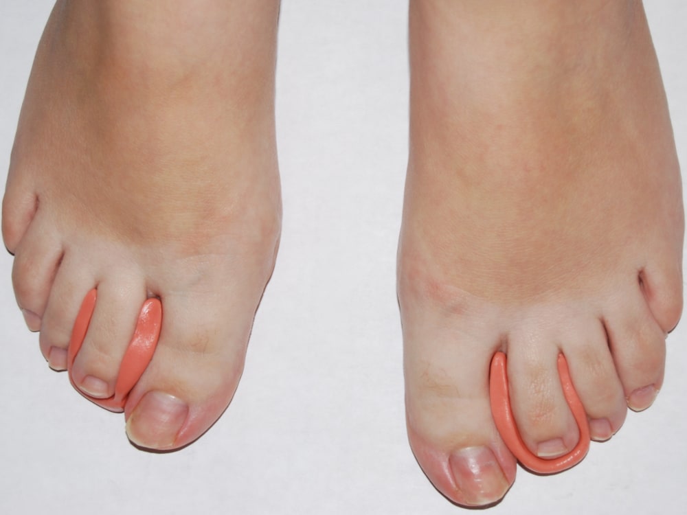 Ortesis para los dedos del pie