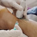 Intervencionismo Ecoguiado