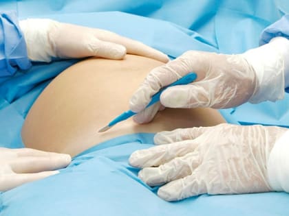 В Балакове врачи борются за жизни 19-летней мамы и её недоношенного младенца