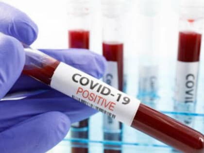 За сутки 331 житель Саратовской области заболел коронавирусом