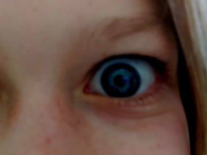 Саратовцам рассказали о причинах ощущения песка в глазах