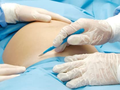 В Балакове 19-летняя беременная впала в кому. Медики спасают ее и сына