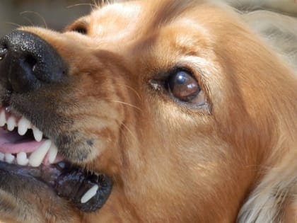 За нападение собаки на ребенка мэрия Саратова заплатит стандартные 20 тысяч