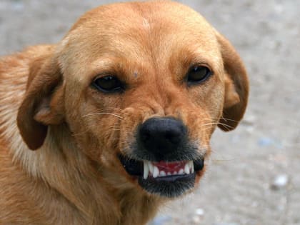 В Саратове от укуса бездомной собаки пострадал еще один ребенок