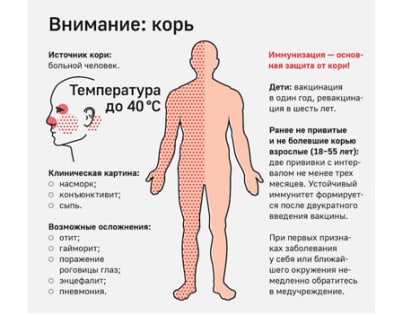 Корь - информация для населения!