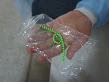 Пятилетняя девочка из Балаково после болей в животе призналась родителям, что проглотила бусы из магнитов: хирурги достали из кишечника 36 фрагментов