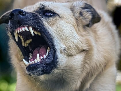 "Лицо, руки, ноги в крови". Саратовцы отгоняли собак от искусанной женщины