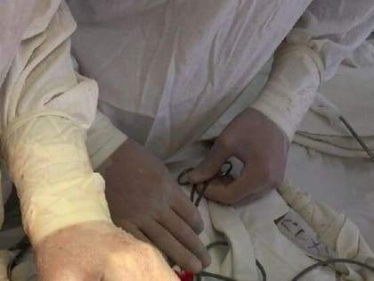 Пациентке из Энгельса удалили 8-килограммовую опухоль