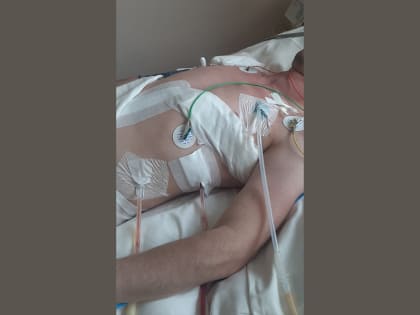 Врачи из Балаково спасли мужчину, которого пырнули ножом в сердце