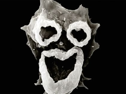 Менингит, энтеровирус и пожирающая мозг амеба в пруду-охладителе Балаковской АЭС. Все возможно в Саратовской области?