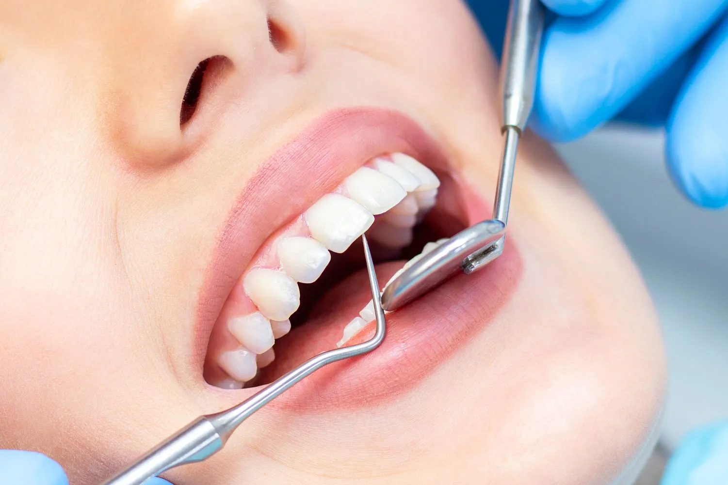 Enhancing Smiles: The Importance of Family and Cosmetic Dentistry