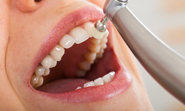 The Importance of Regular Visits to Your General Dentist