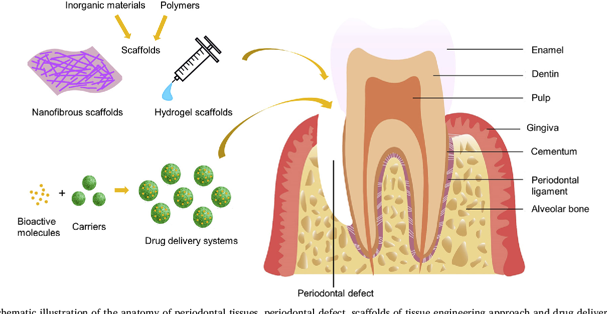 Periodontal Regeneration: A Closer Look