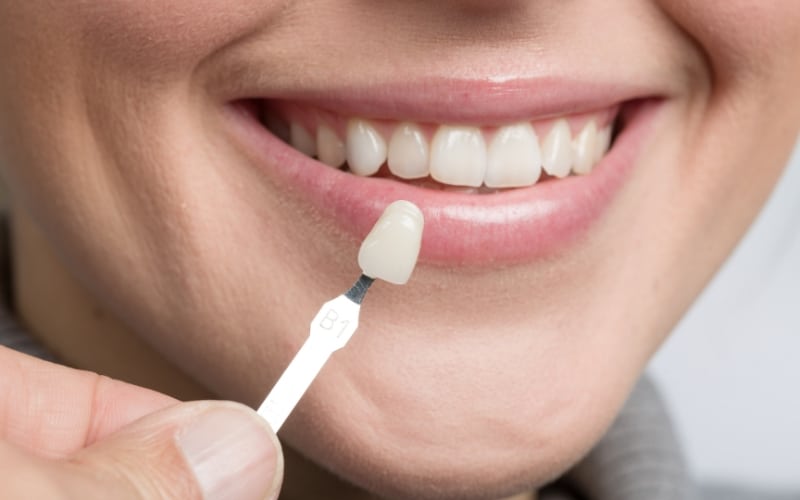 How To Maintain Your Smile Post Cosmetic Dentistry