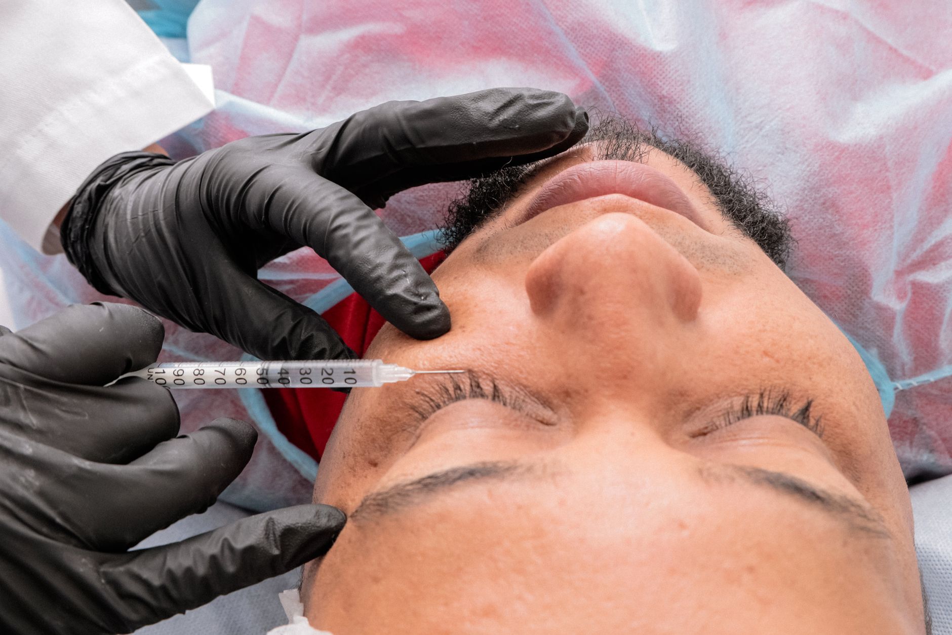 Top 5 Myths about Dermatology Debunked