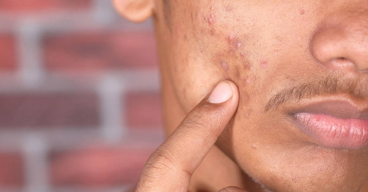 Debunking Myths About Visiting a Dermatologist