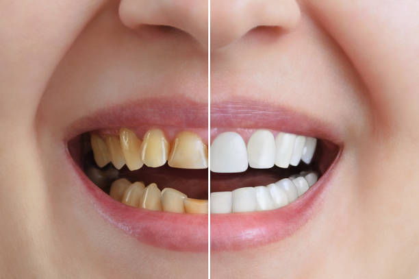 Top 6 Reasons to Visit a Cosmetic Dentist in Livermore, CA