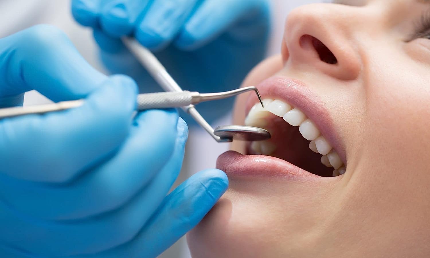 Should you consider Invisalign aligners? Find here!