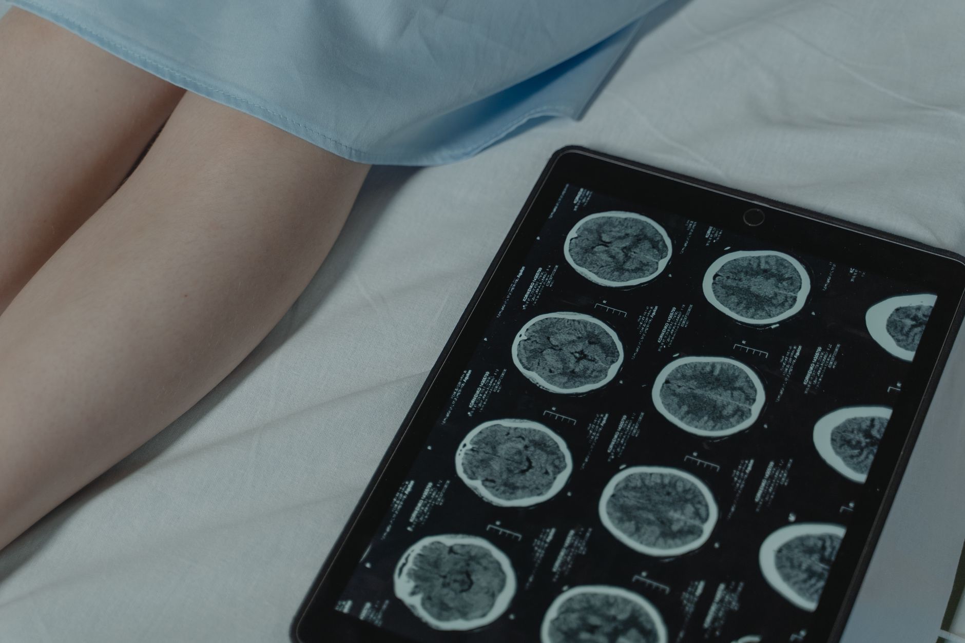 X-Ray Radiology Is Beneficial for Critical Diseases