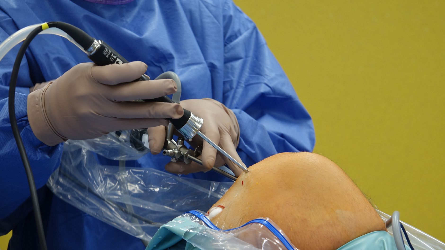 Orthopedic Surgeons And Sports Injuries: An Overview