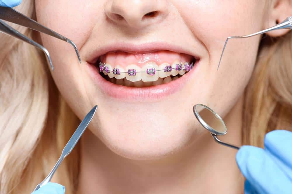 The Psychology Of Smiling: The Role Of Orthodontics
