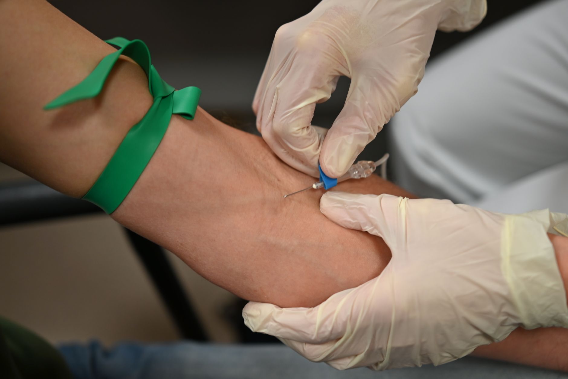 The Role Of Vascular Surgeons In The Management Of Deep Vein Thrombosis (DVT)