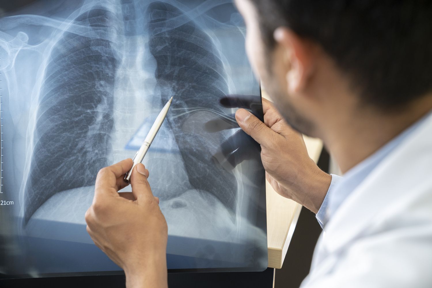The Importance Of Pulmonology In Icu
