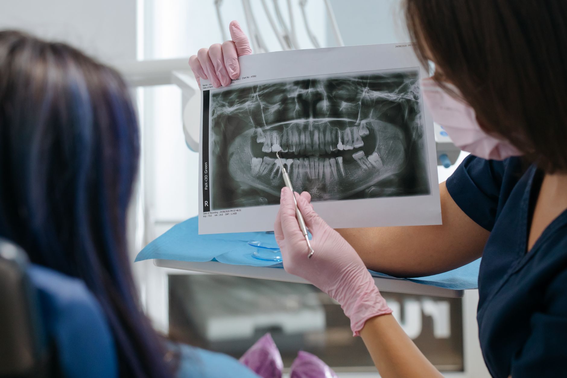 Decoding Dental X-Rays: What Your General Dentist Is Looking For
