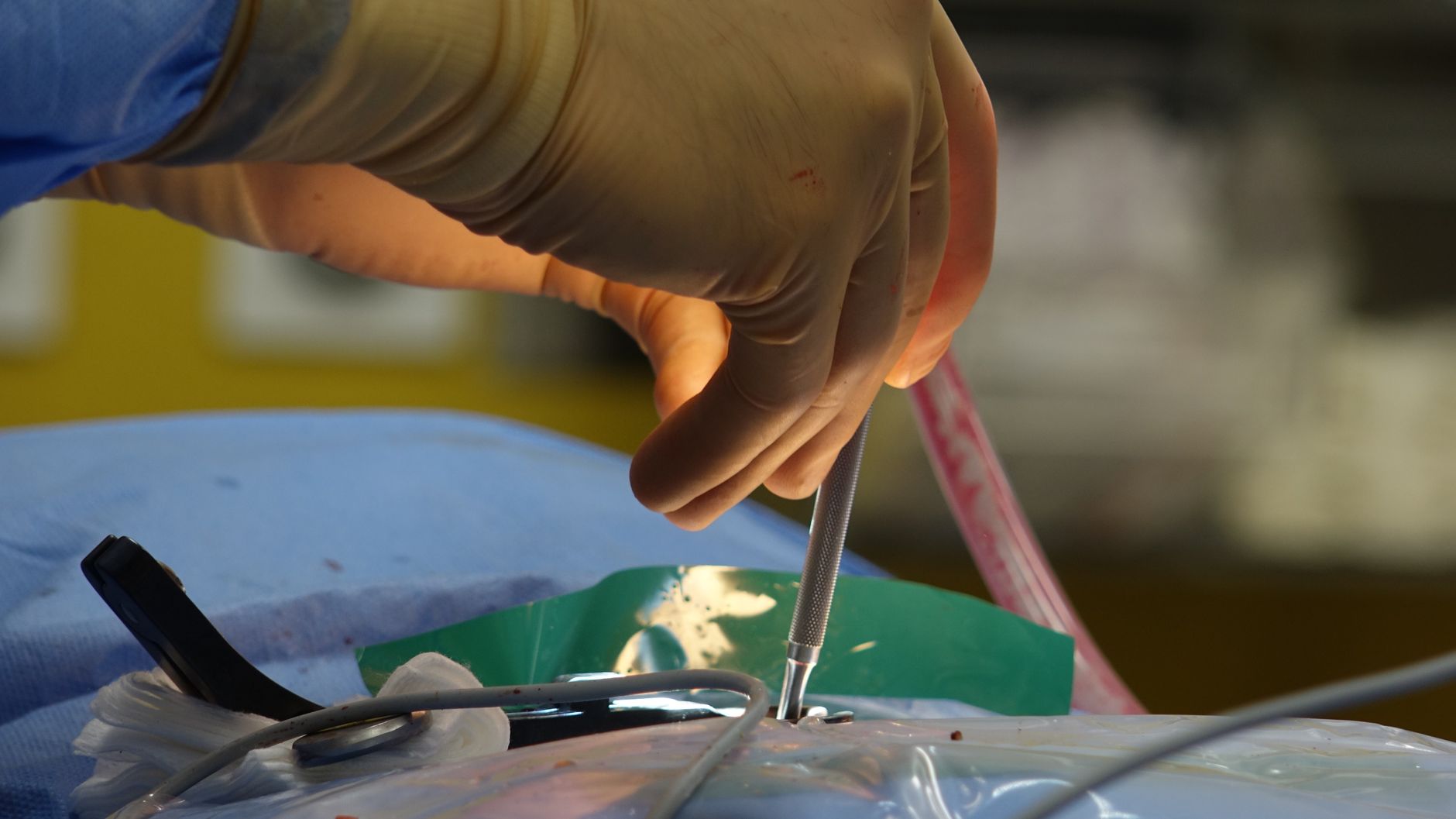 The Role Of An Orthopedic Surgeon In Trauma Cases