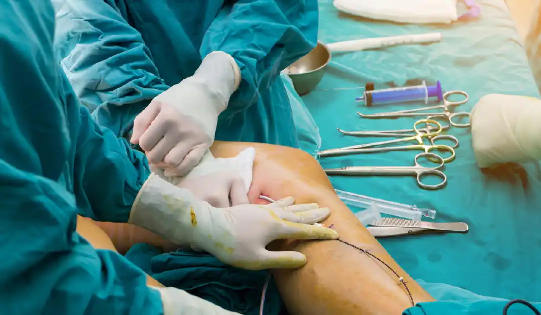 The Role Of An Orthopedic Surgeon In Trauma Cases