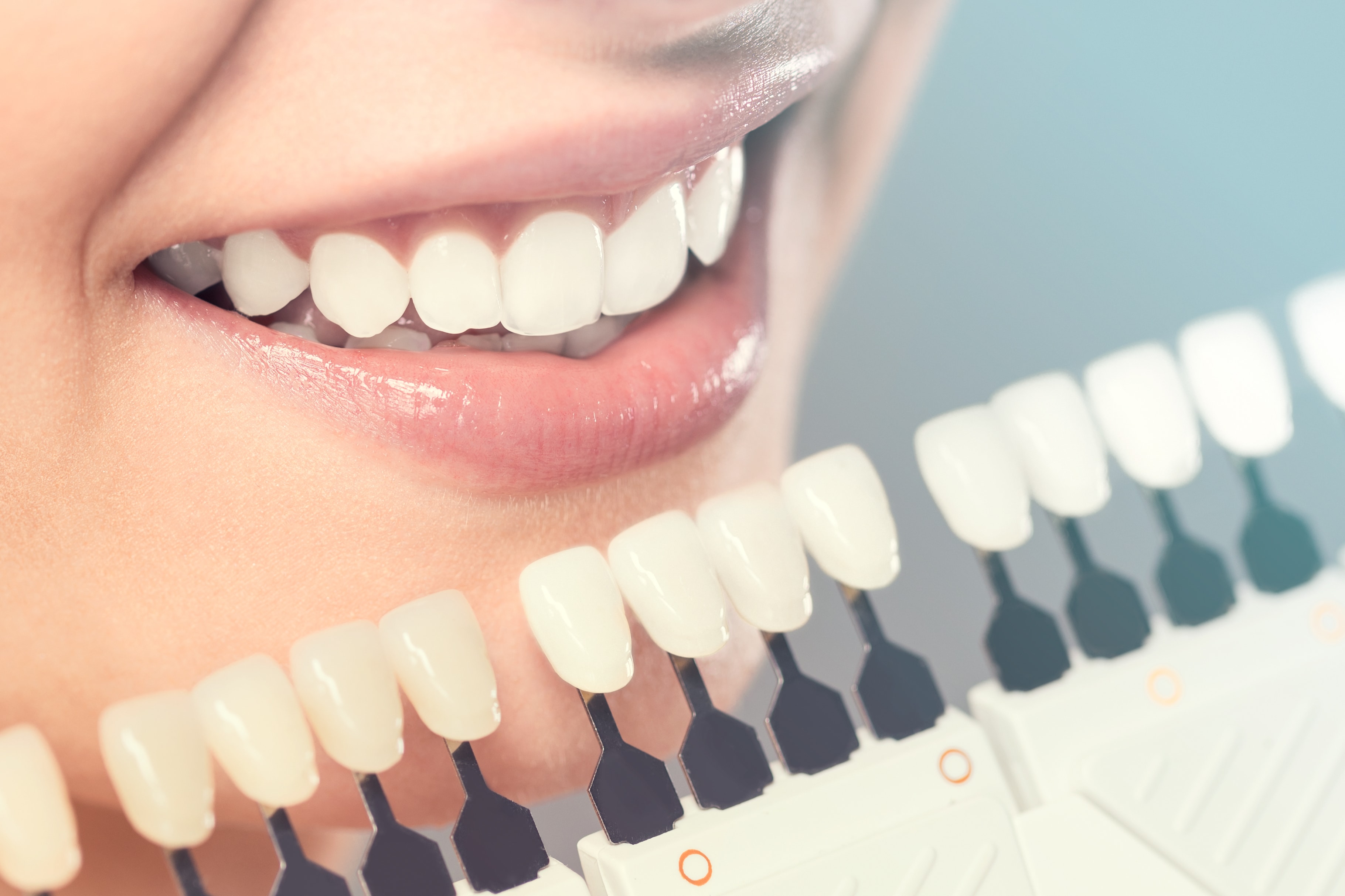 5 Ways Cosmetic Dentistry Can Improve Your Smile