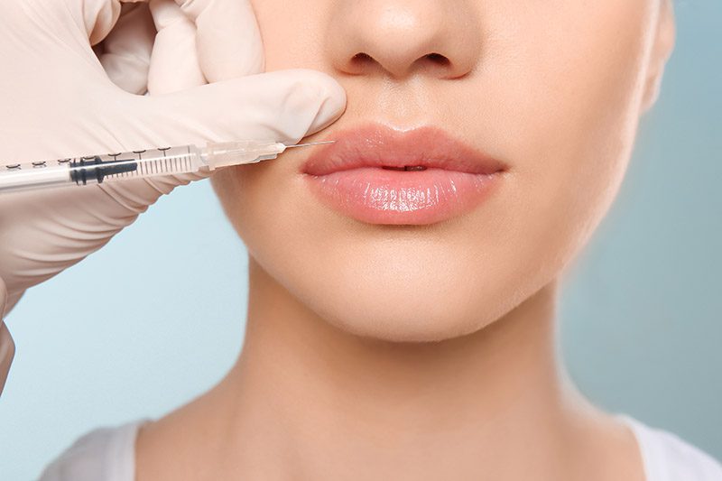 Dermal Fillers: What to Know Before You Try