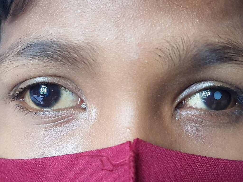 Recognizing Cataracts Early and Understanding How They Affect Vision