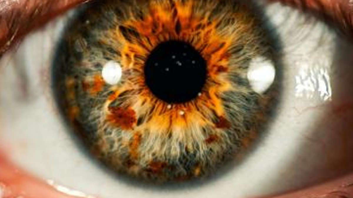 13-second eye test shows brain injury recovery progress - brain injury recovery